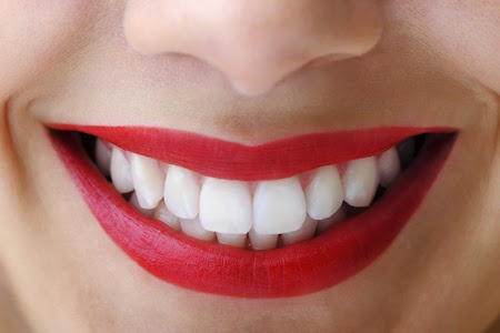 Teeth whitening can improve the look of your smile and give you much more confidence. 